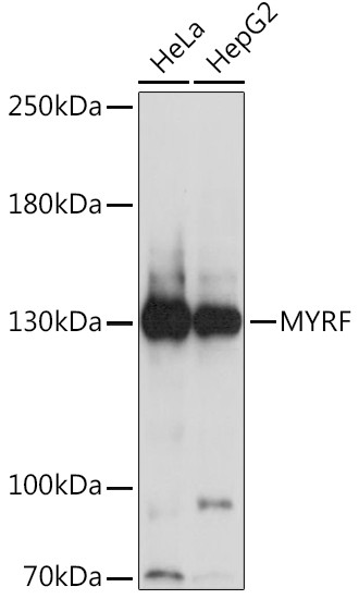 C11orf9 Antibody in Western Blot (WB)