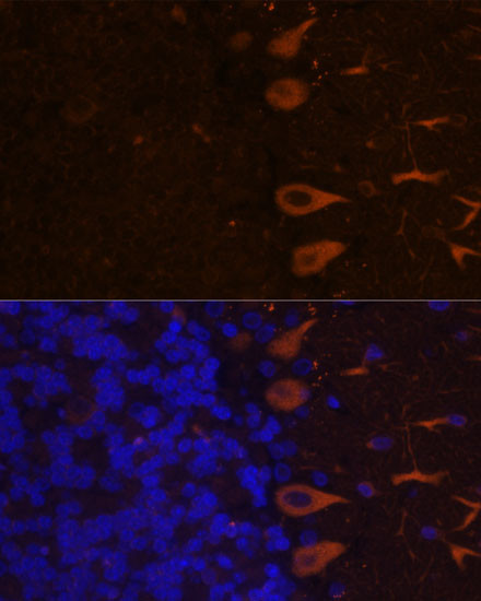 KAL1 Antibody in Immunohistochemistry (Paraffin) (IHC (P))