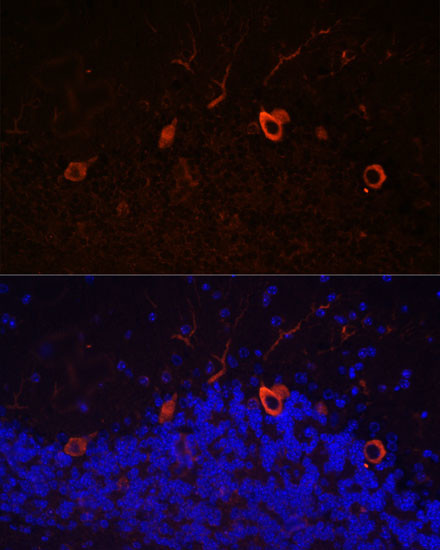 KAL1 Antibody in Immunohistochemistry (Paraffin) (IHC (P))