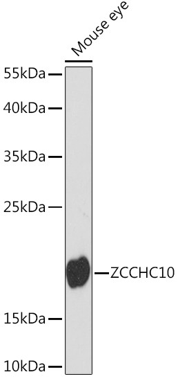 ZCCHC10 Antibody in Western Blot (WB)