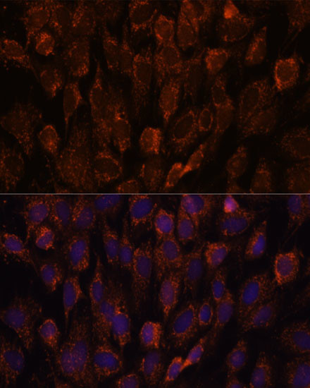 NSDHL Antibody in Immunocytochemistry (ICC/IF)