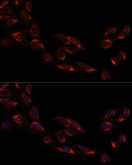 NSDHL Antibody in Immunocytochemistry (ICC/IF)