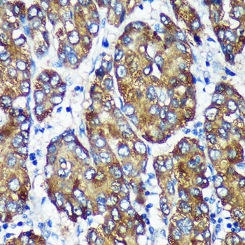 NSDHL Antibody in Immunohistochemistry (Paraffin) (IHC (P))