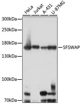 SFRS8 Antibody in Western Blot (WB)