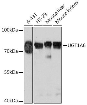 UGT1A6 Antibody in Western Blot (WB)