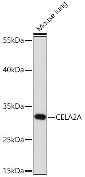 CELA2A Antibody in Western Blot (WB)