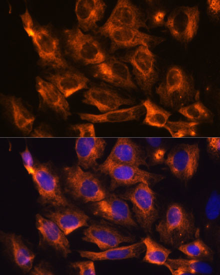 FAT4 Antibody in Immunocytochemistry (ICC/IF)