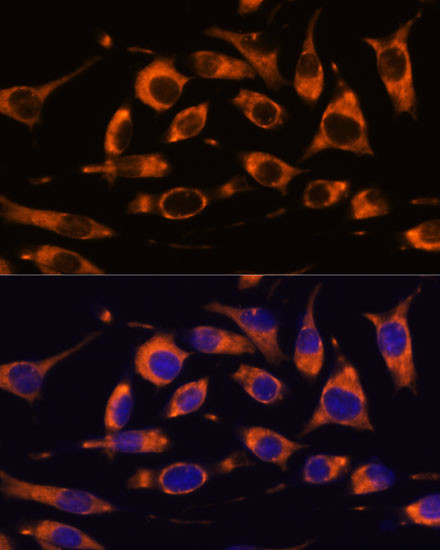 FAT4 Antibody in Immunocytochemistry (ICC/IF)