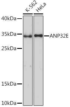 ANP32E Antibody in Western Blot (WB)