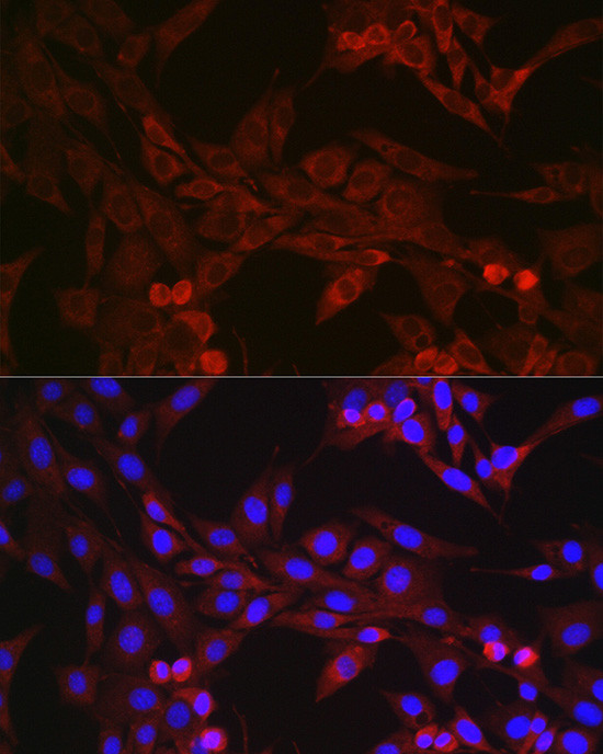 GSDMD Antibody in Immunocytochemistry (ICC/IF)