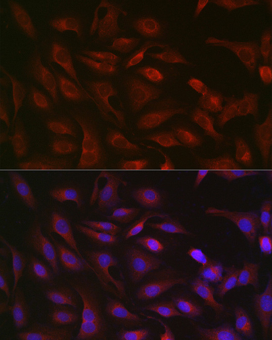 GSDMD Antibody in Immunocytochemistry (ICC/IF)