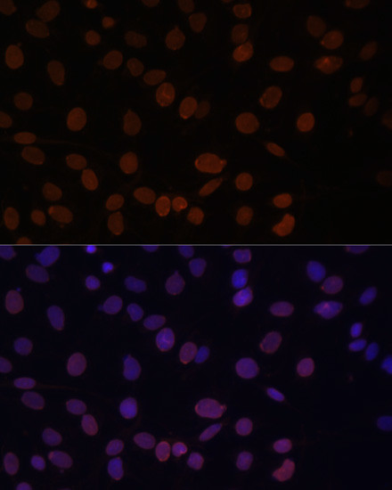 Lamin A/C Antibody in Immunocytochemistry (ICC/IF)