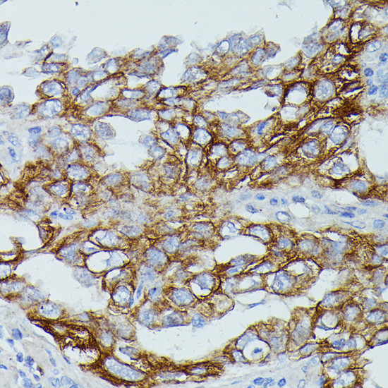 FCGR1B Antibody in Immunohistochemistry (Paraffin) (IHC (P))