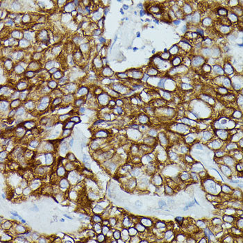 FCGR1B Antibody in Immunohistochemistry (Paraffin) (IHC (P))