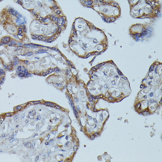 FCGR1B Antibody in Immunohistochemistry (Paraffin) (IHC (P))