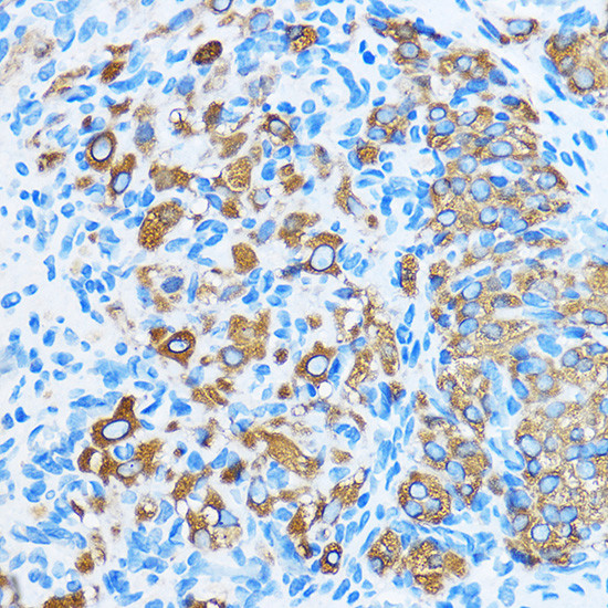 COG1 Antibody in Immunohistochemistry (Paraffin) (IHC (P))