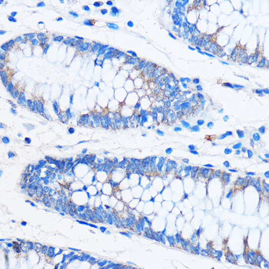 COG1 Antibody in Immunohistochemistry (Paraffin) (IHC (P))