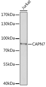 Calpain 7 Antibody in Western Blot (WB)