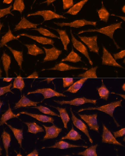 ABHD4 Antibody in Immunocytochemistry (ICC/IF)