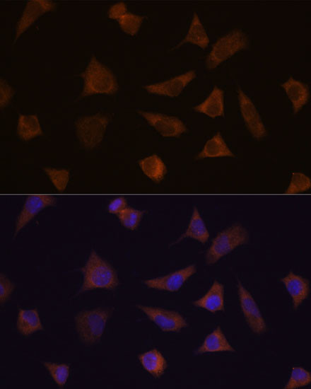 ENAH Antibody in Immunocytochemistry (ICC/IF)