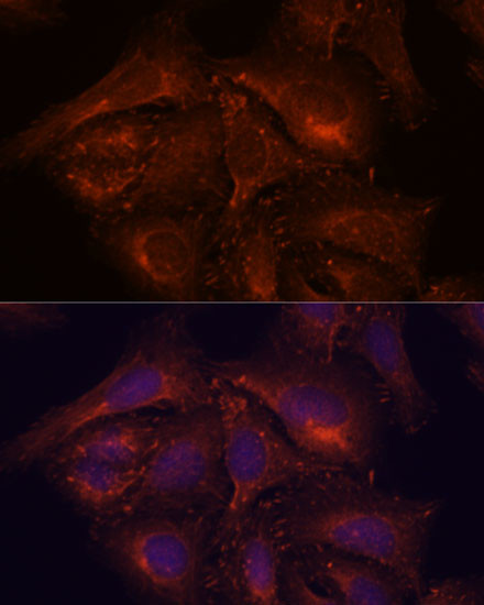 ENAH Antibody in Immunocytochemistry (ICC/IF)