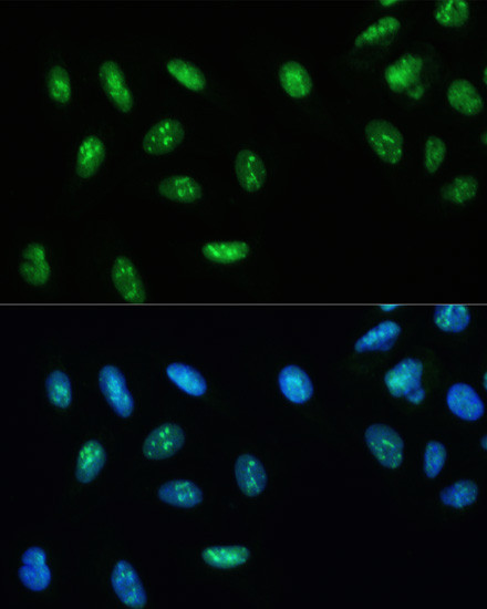 DHX9 Antibody in Immunocytochemistry (ICC/IF)