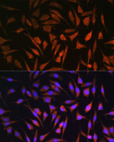 RALGDS Antibody in Immunocytochemistry (ICC/IF)