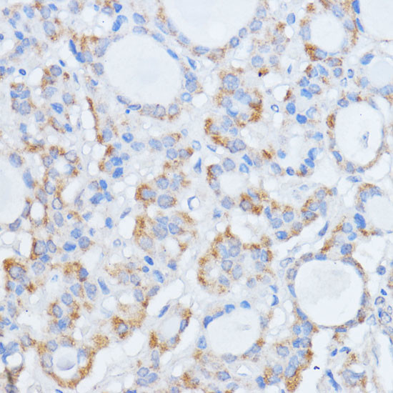 RALGDS Antibody in Immunohistochemistry (Paraffin) (IHC (P))