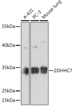 ZDHHC7 Antibody in Western Blot (WB)