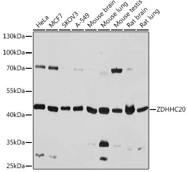 ZDHHC20 Antibody in Western Blot (WB)