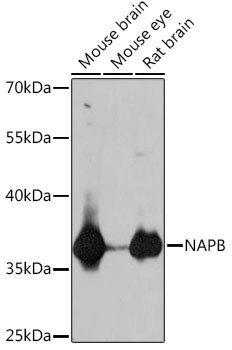 NAPB Antibody in Western Blot (WB)