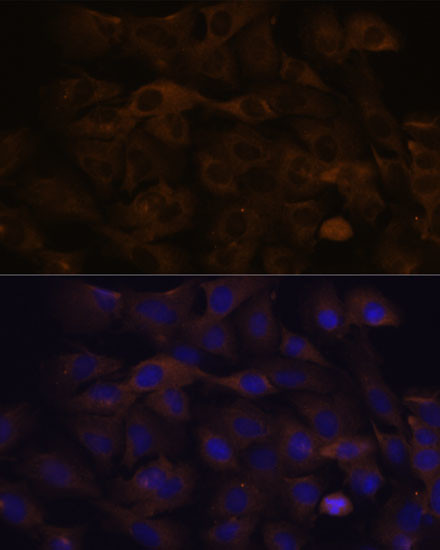 GRSF1 Antibody in Immunocytochemistry (ICC/IF)