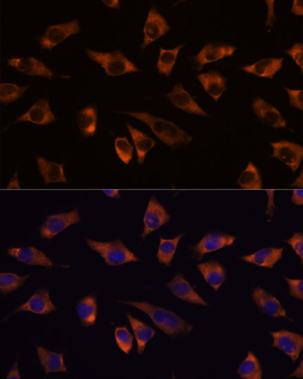 GRSF1 Antibody in Immunocytochemistry (ICC/IF)