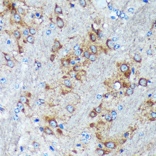 GRSF1 Antibody in Immunohistochemistry (Paraffin) (IHC (P))