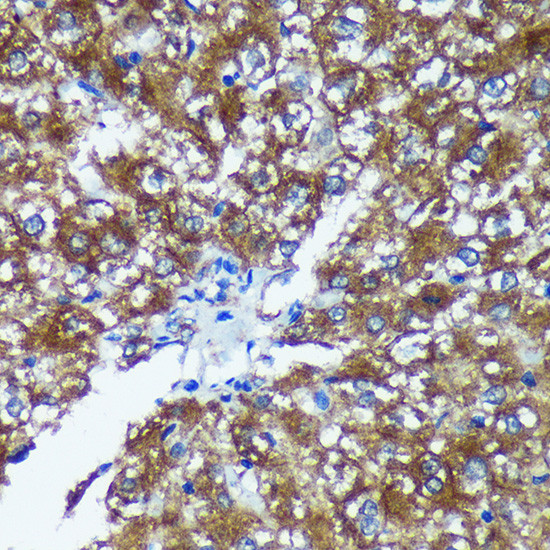 GRSF1 Antibody in Immunohistochemistry (Paraffin) (IHC (P))