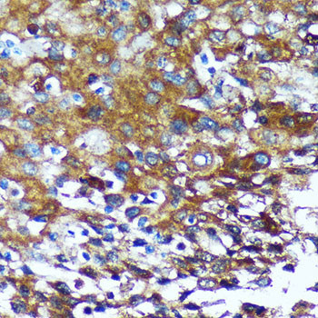 GRSF1 Antibody in Immunohistochemistry (Paraffin) (IHC (P))