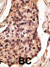 SIGLEC8 Antibody in Immunohistochemistry (Paraffin) (IHC (P))