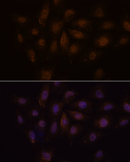 PCQAP Antibody in Immunocytochemistry (ICC/IF)