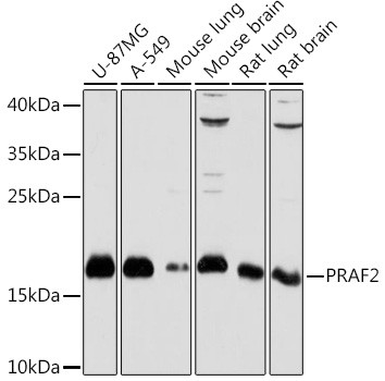 JM4 Antibody in Western Blot (WB)