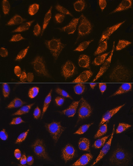 BRUNOL5 Antibody in Immunocytochemistry (ICC/IF)