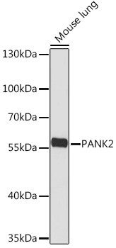 PANK2 Antibody in Western Blot (WB)