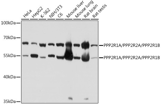 PPP2R1A/PPP2R2A/PPP2R1B Antibody in Western Blot (WB)