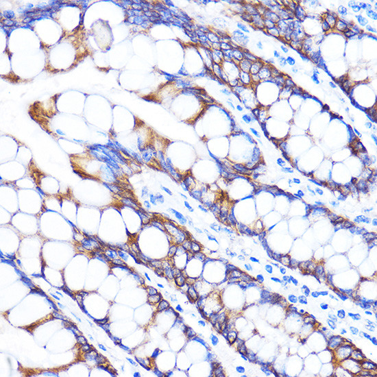 ZMPSTE24 Antibody in Immunohistochemistry (Paraffin) (IHC (P))