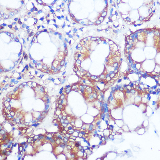 Collagen X Antibody in Immunohistochemistry (Paraffin) (IHC (P))