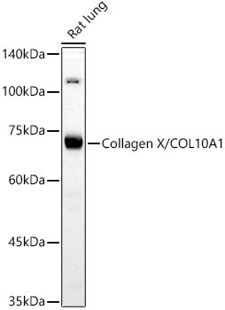 Collagen X Antibody in Western Blot (WB)