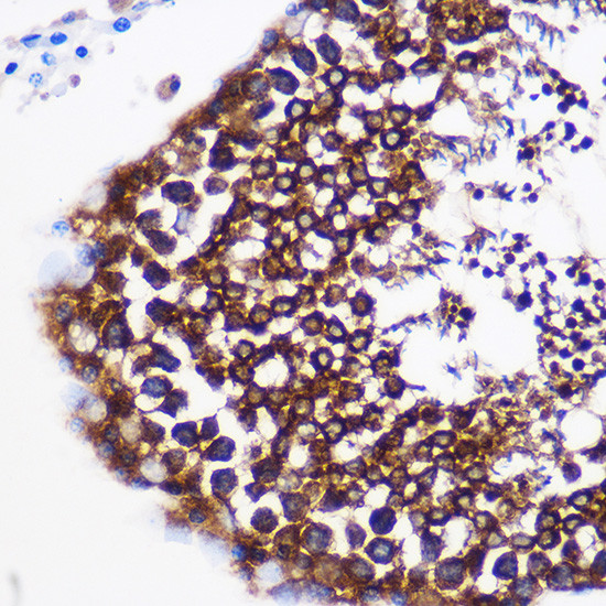 PTGES Antibody in Immunohistochemistry (Paraffin) (IHC (P))