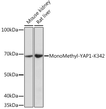 Methyl-YAP1 (Lys342) Antibody in Western Blot (WB)