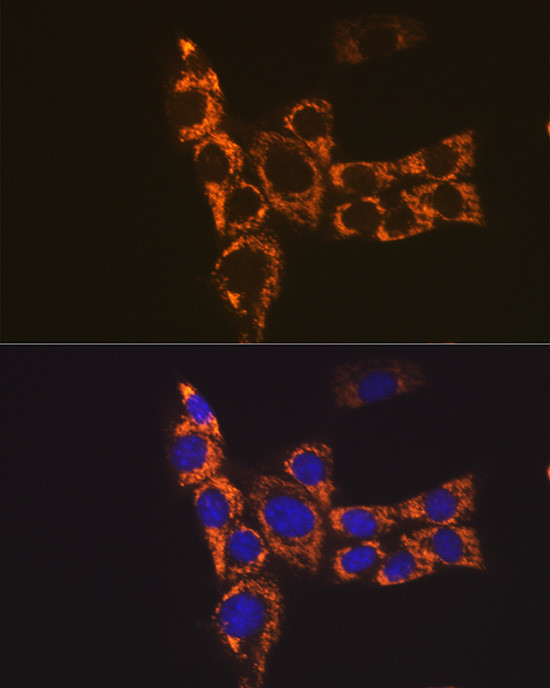 MHC Class II (I-Ab) Antibody in Immunocytochemistry (ICC/IF)