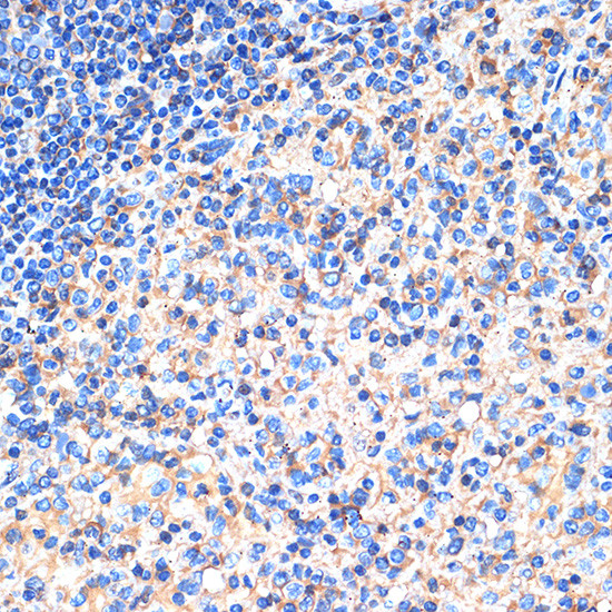 SIGLEC15 Antibody in Immunohistochemistry (Paraffin) (IHC (P))