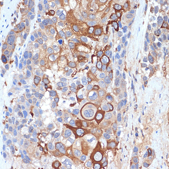 SIGLEC15 Antibody in Immunohistochemistry (Paraffin) (IHC (P))